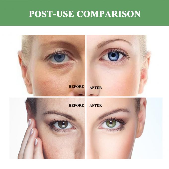 नियमित आकार एंटी एजिंग मॉइस्चराइजर ऑर्गेनिक प्राकृतिक adult wrinkle lifting cream 7