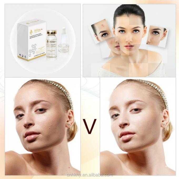 QBEKA Happy Cosmetics के साथ मुँहासे के निशानों को दूर करें 0